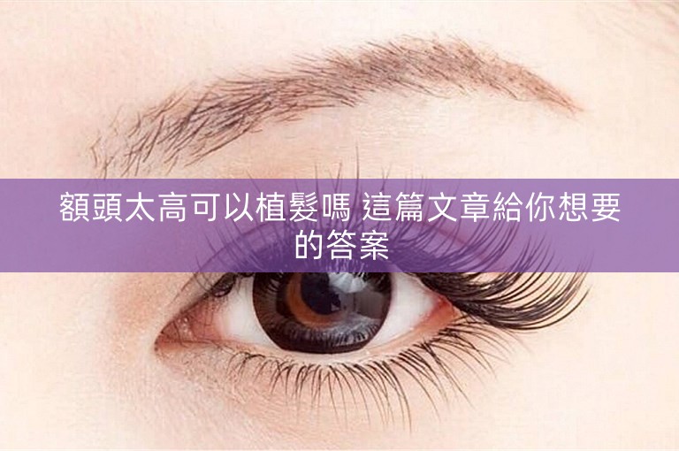 額頭太高可以植髮嗎 這篇文章給你想要的答案