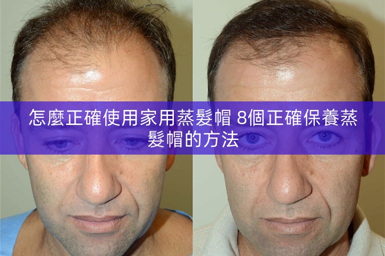 怎麼正確使用家用蒸髮帽 8個正確保養蒸髮帽的方法