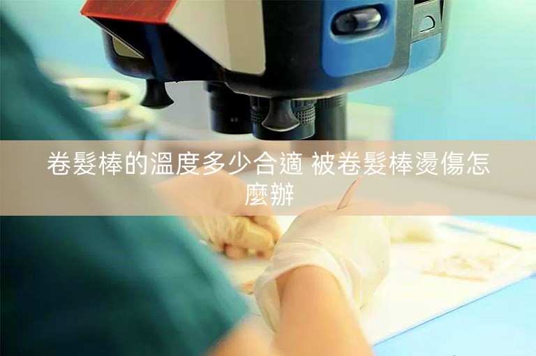 卷髮棒的溫度多少合適 被卷髮棒燙傷怎麼辦 卷髮棒的溫度多少合適 被卷髮棒燙傷怎麼辦