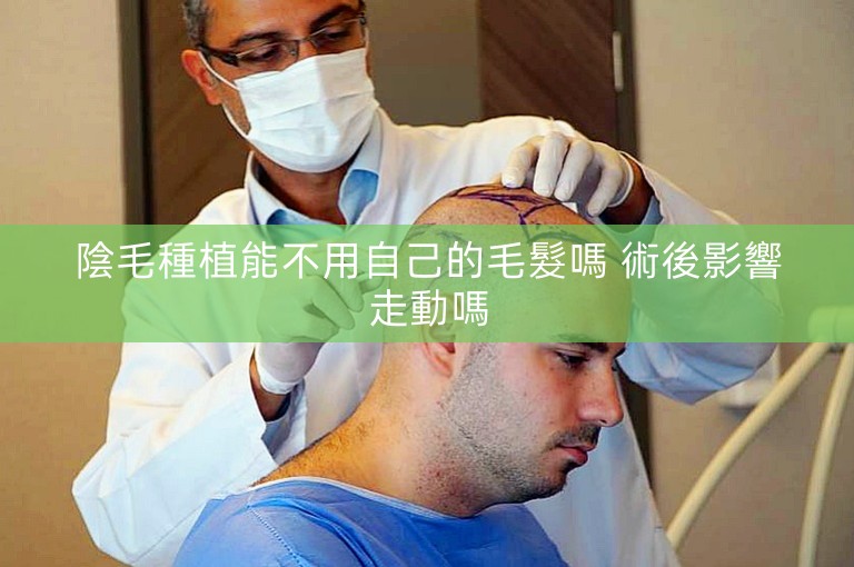 陰毛種植能不用自己的毛髮嗎 術後影響走動嗎