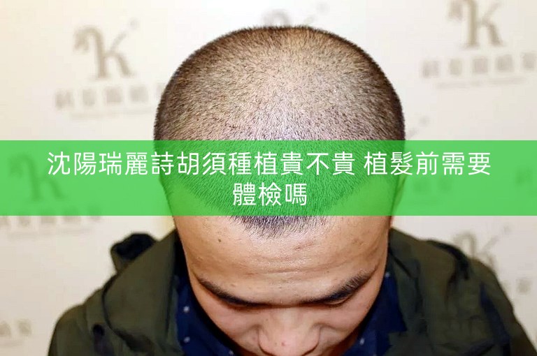 沈陽瑞麗詩胡須種植貴不貴 植髮前需要體檢嗎