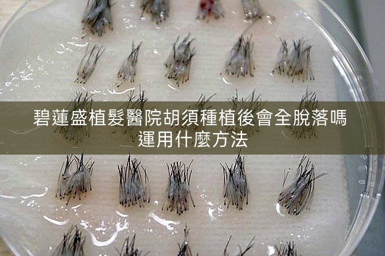 碧蓮盛植髮醫院胡須種植後會全脫落嗎 運用什麼方法