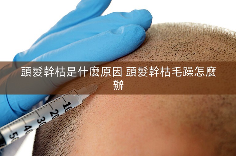 頭髮幹枯是什麼原因 頭髮幹枯毛躁怎麼辦