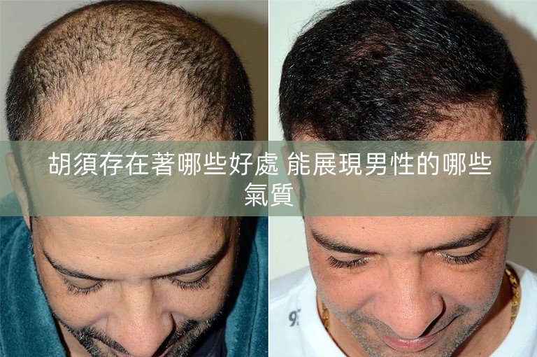 胡須存在著哪些好處 能展現男性的哪些氣質 胡須存在著哪些好處 能展現男性的哪些氣質