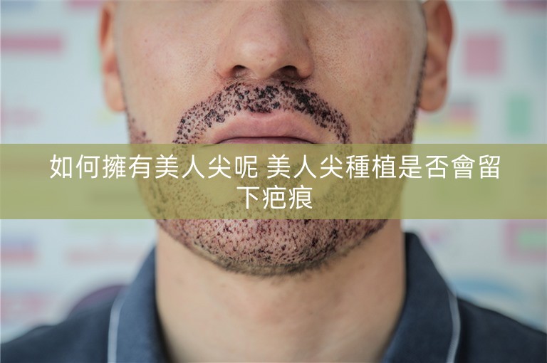 如何擁有美人尖呢 美人尖種植是否會留下疤痕