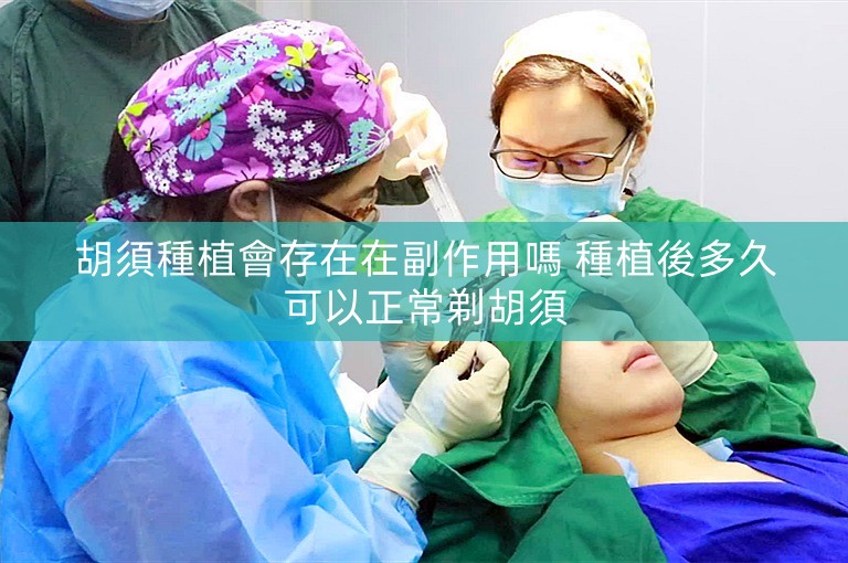 胡須種植會存在在副作用嗎 種植後多久可以正常剃胡須