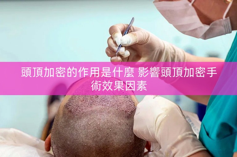 頭頂加密的作用是什麼 影響頭頂加密手術效果因素