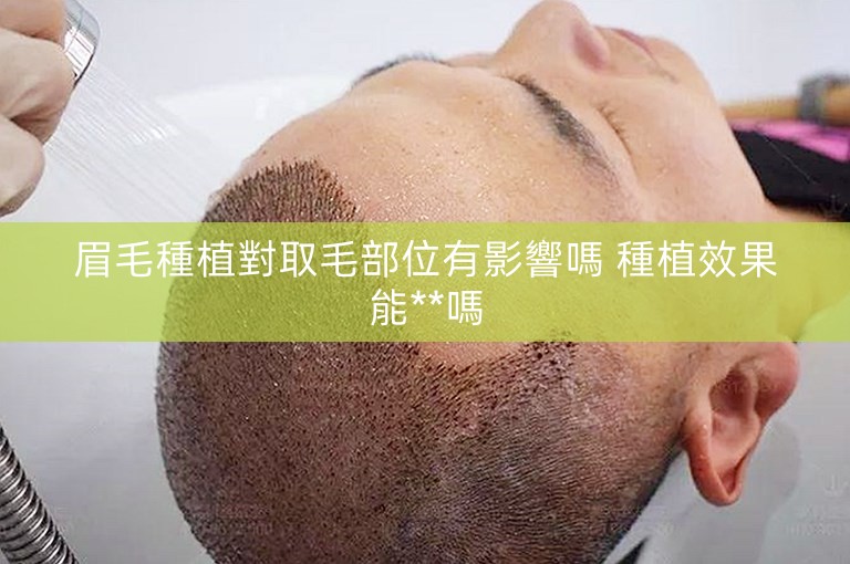 眉毛種植對取毛部位有影響嗎 種植效果能**嗎