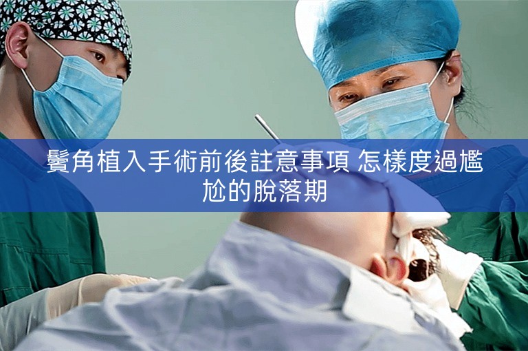 鬢角植入手術前後註意事項 怎樣度過尷尬的脫落期
