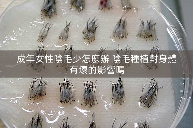 成年女性陰毛少怎麼辦 陰毛種植對身體有壞的影響嗎 成年女性陰毛少怎麼辦 陰毛種植對身體有壞的影響嗎