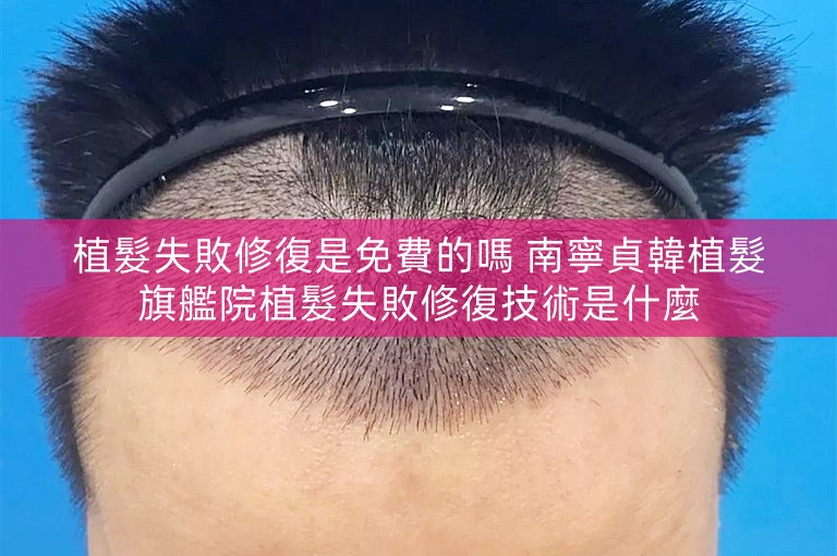 植髮失敗修復是免費的嗎 南寧貞韓植髮旗艦院植髮失敗修復技術是什麼