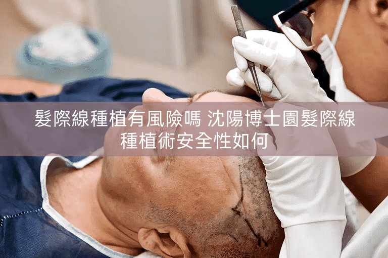 髮際線種植有風險嗎 沈陽博士園髮際線種植術安全性如何