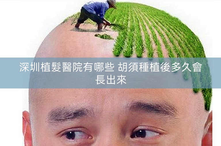 深圳植髮醫院有哪些 胡須種植後多久會長出來