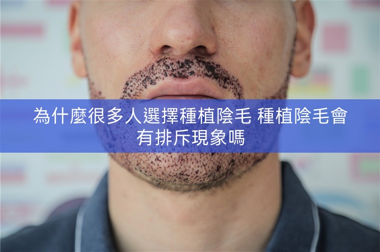為什麼很多人選擇種植陰毛 種植陰毛會有排斥現象嗎 為什麼很多人選擇種植陰毛 種植陰毛會有排斥現象嗎