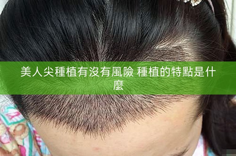 美人尖種植有沒有風險 種植的特點是什麼