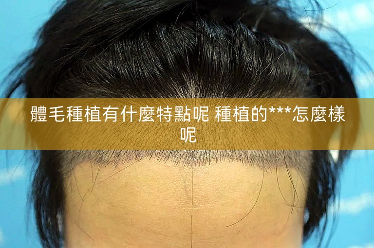 體毛種植有什麼特點呢 種植的***怎麼樣呢