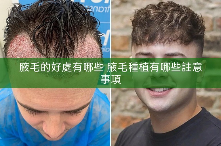 腋毛的好處有哪些 腋毛種植有哪些註意事項