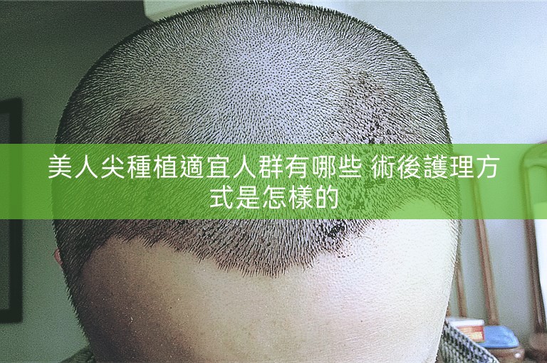 美人尖種植適宜人群有哪些 術後護理方式是怎樣的