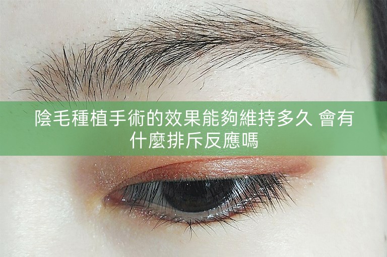 陰毛種植手術的效果能夠維持多久 會有什麼排斥反應嗎
