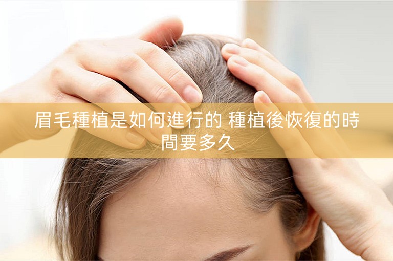 眉毛種植是如何進行的 種植後恢復的時間要多久