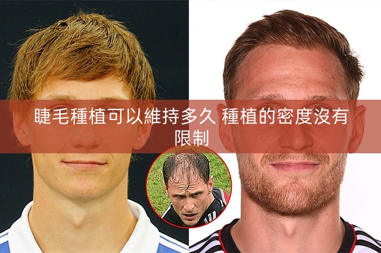 睫毛種植可以維持多久 種植的密度沒有限制