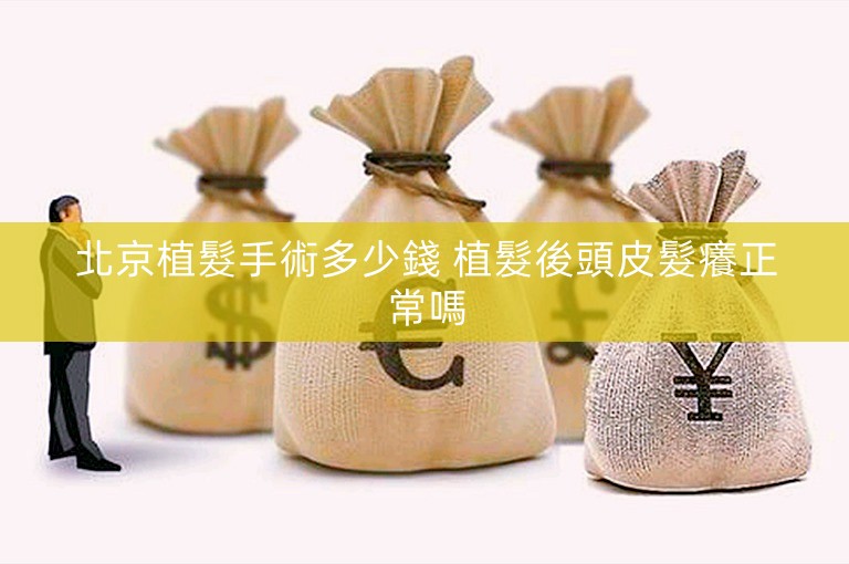 北京植髮手術多少錢 植髮後頭皮髮癢正常嗎