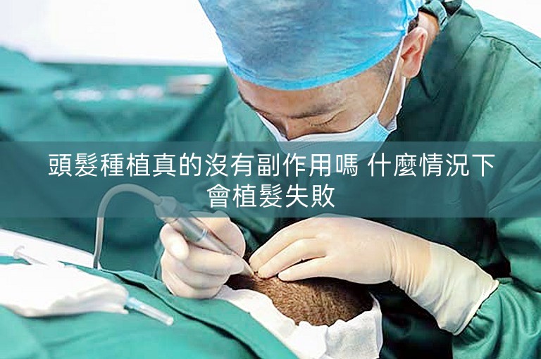 頭髮種植真的沒有副作用嗎 什麼情況下會植髮失敗