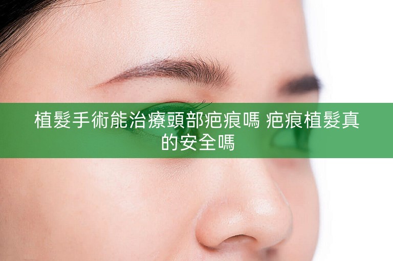 植髮手術能治療頭部疤痕嗎 疤痕植髮真的安全嗎 植髮手術能治療頭部疤痕嗎 疤痕植髮真的安全嗎