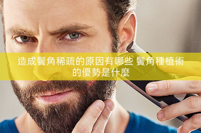 造成鬢角稀疏的原因有哪些 鬢角種植術的優勢是什麼