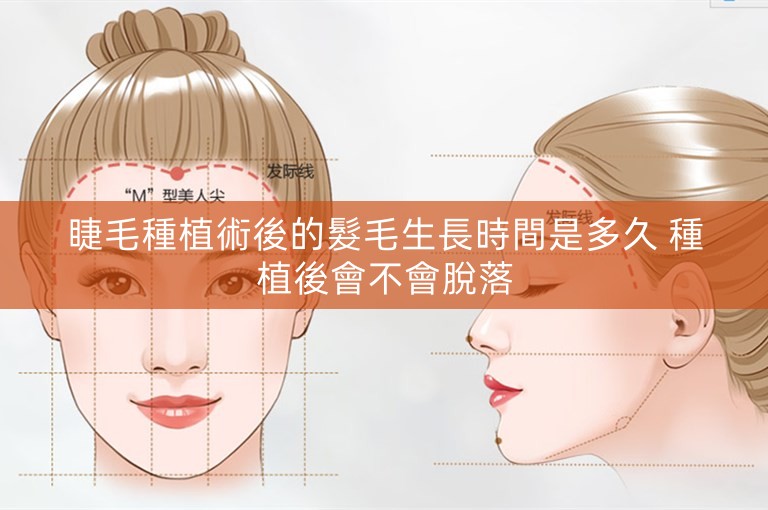 睫毛種植術後的髮毛生長時間是多久 種植後會不會脫落
