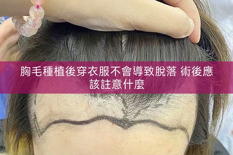 胸毛種植後穿衣服不會導致脫落 術後應該註意什麼 胸毛種植後穿衣服不會導致脫落 術後應該註意什麼
