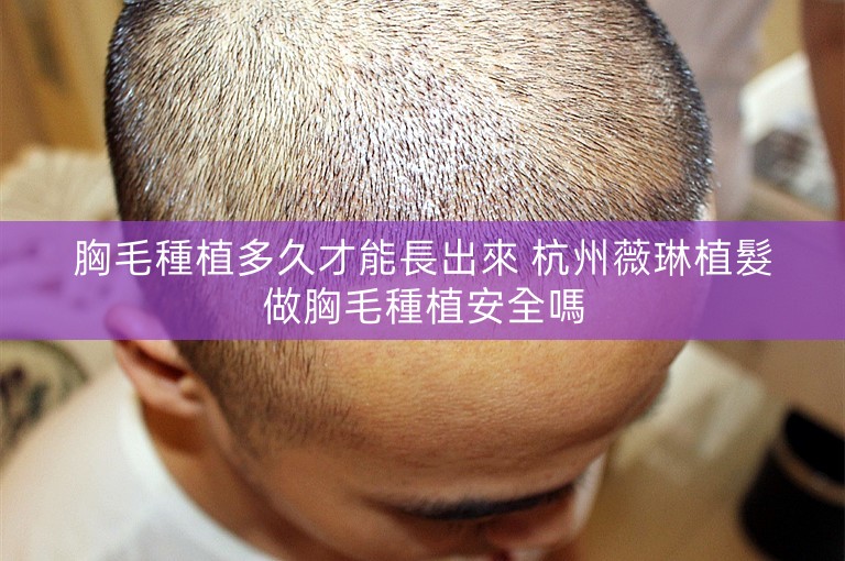 胸毛種植多久才能長出來 杭州薇琳植髮做胸毛種植安全嗎