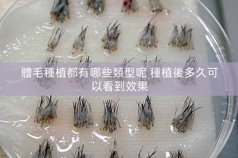 體毛種植都有哪些類型呢 種植後多久可以看到效果