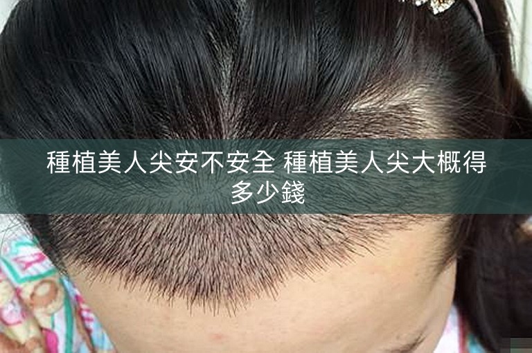 種植美人尖安不安全 種植美人尖大概得多少錢