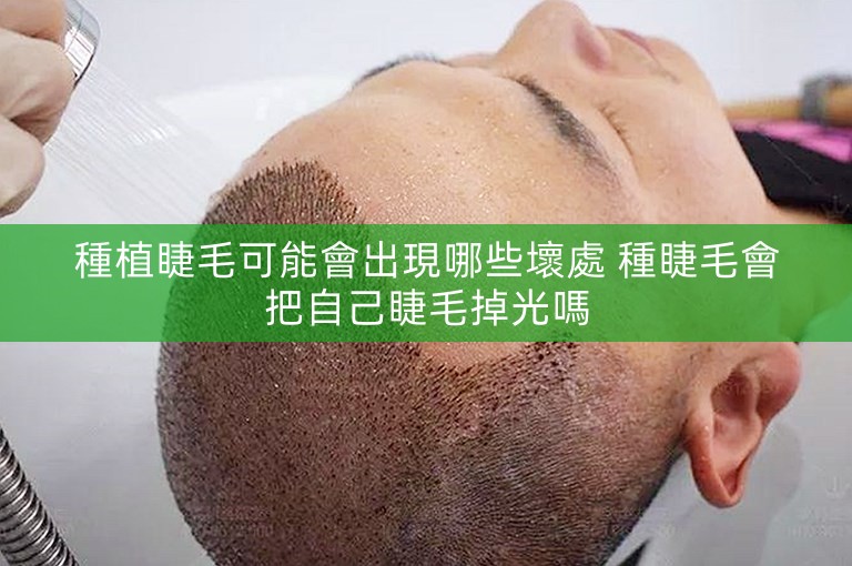 種植睫毛可能會出現哪些壞處 種睫毛會把自己睫毛掉光嗎