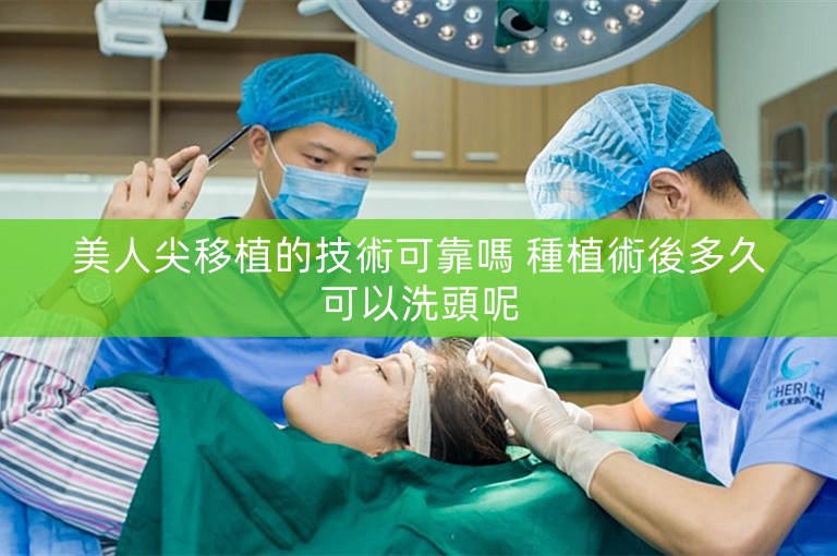 美人尖移植的技術可靠嗎 種植術後多久可以洗頭呢