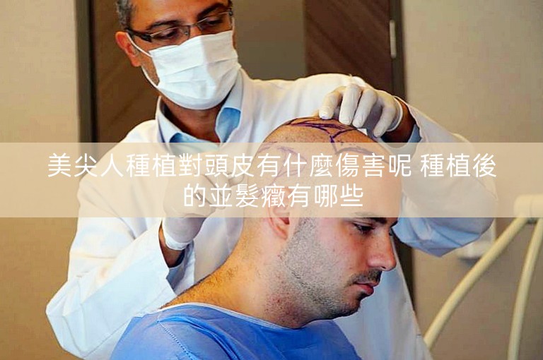 美尖人種植對頭皮有什麼傷害呢 種植後的並髮癥有哪些