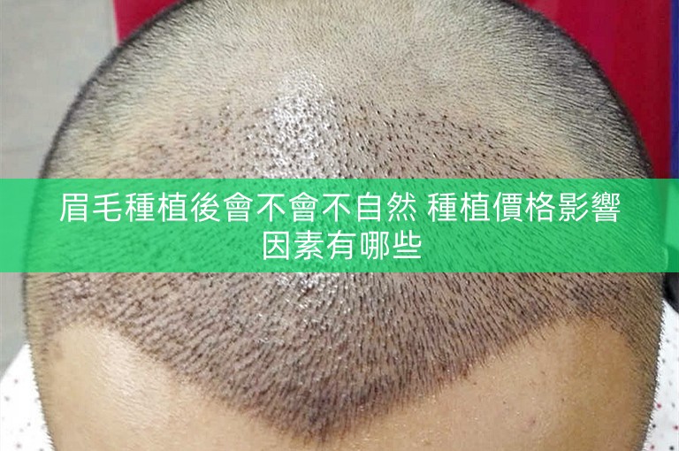 眉毛種植後會不會不自然 種植價格影響因素有哪些