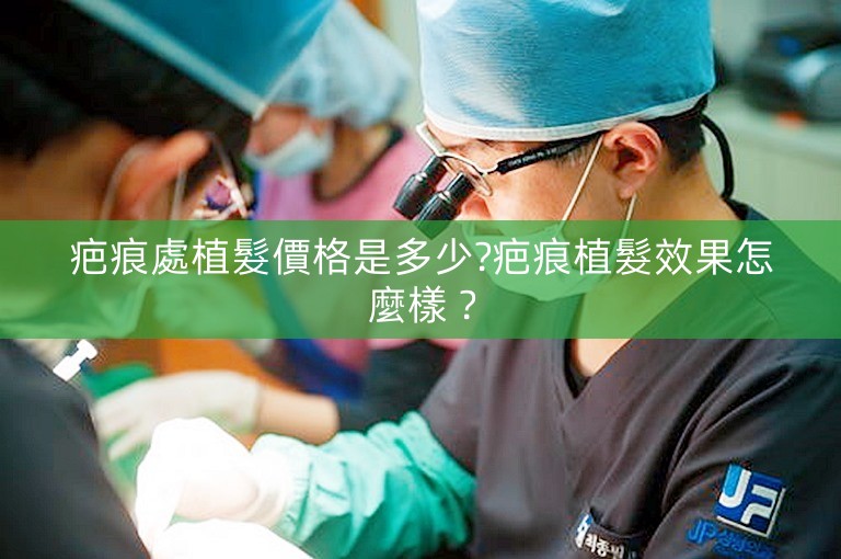 疤痕處植髮價格是多少?疤痕植髮效果怎麼樣？