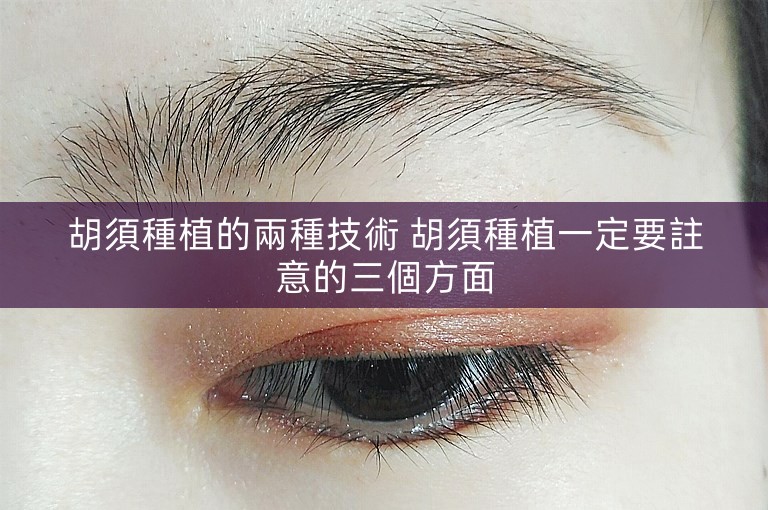胡須種植的兩種技術 胡須種植一定要註意的三個方面