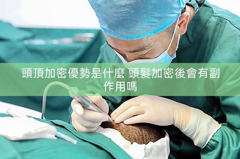 頭頂加密優勢是什麼 頭髮加密後會有副作用嗎