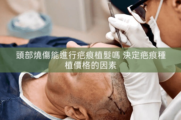 頭部燒傷能進行疤痕植髮嗎 決定疤痕種植價格的因素
