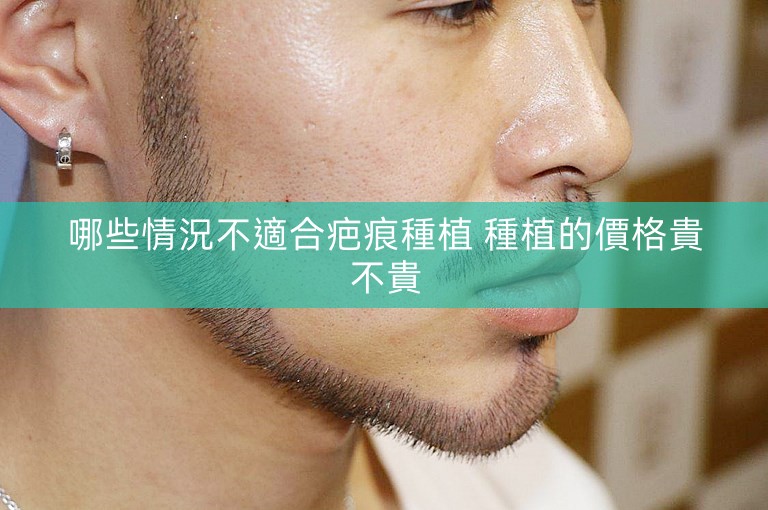 哪些情況不適合疤痕種植 種植的價格貴不貴
