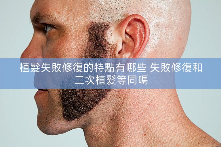 植髮失敗修復的特點有哪些 失敗修復和二次植髮等同嗎