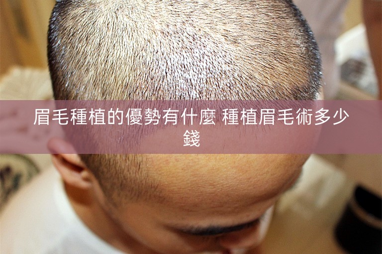 眉毛種植的優勢有什麼 種植眉毛術多少錢