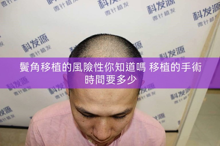 鬢角移植的風險性你知道嗎 移植的手術時間要多少