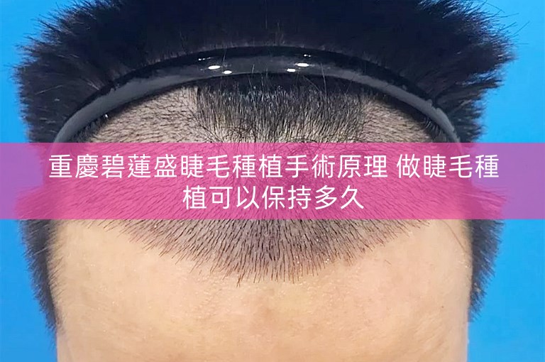 重慶碧蓮盛睫毛種植手術原理 做睫毛種植可以保持多久