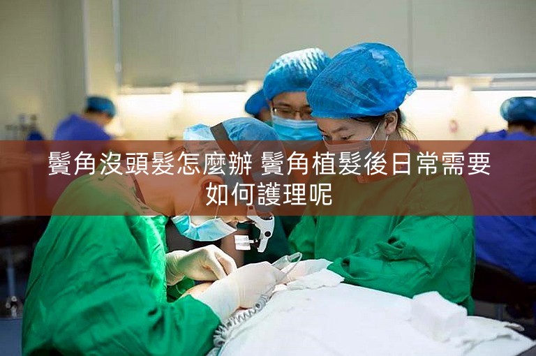 鬢角沒頭髮怎麼辦 鬢角植髮後日常需要如何護理呢