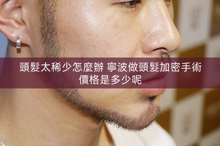 頭髮太稀少怎麼辦 寧波做頭髮加密手術價格是多少呢