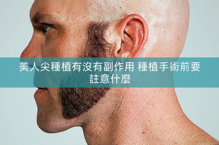 美人尖種植有沒有副作用 種植手術前要註意什麼